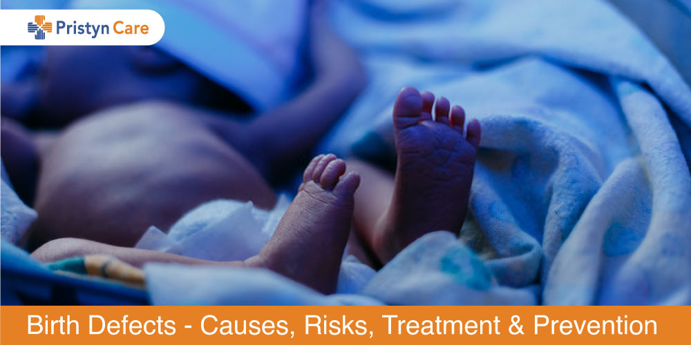 Birth Defects Causes Risks Treatment And Prevention Pristyn Care 