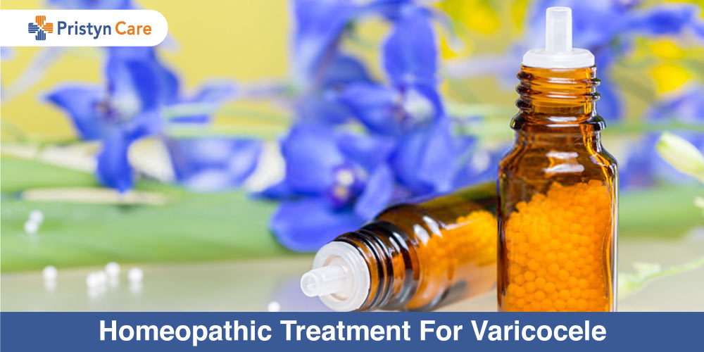 Varicocele Be Gone: Exploring Effective Treatments, by bharat homeopathy