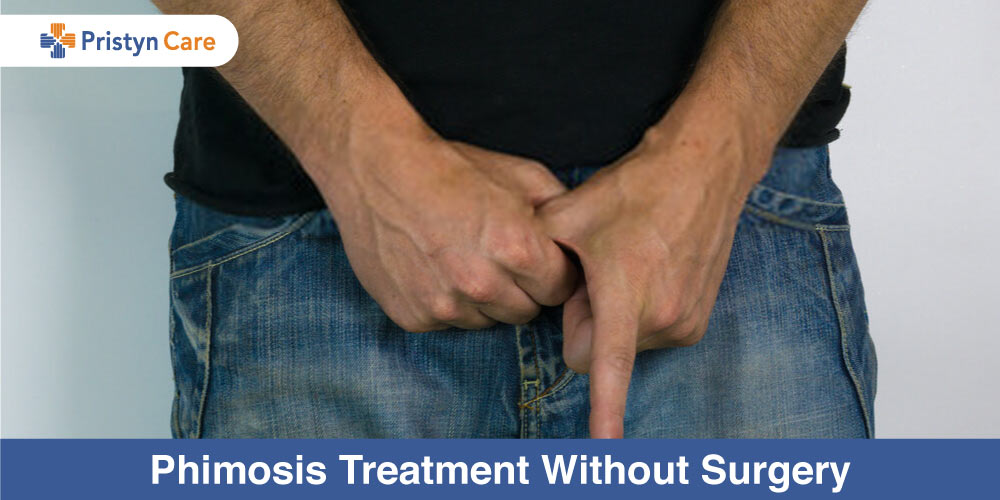 Phimosis Treatment Without Surgery
