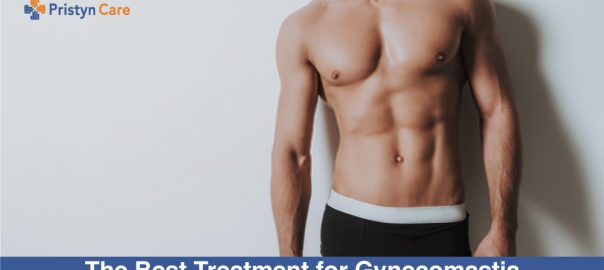 The Best Treatment for Gynecomastia