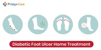 Signs And Symptoms Of Diabetic Foot Ulcer - Pristyn Care