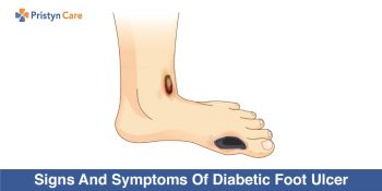 Signs And Symptoms Of Diabetic Foot Ulcer - Pristyn Care