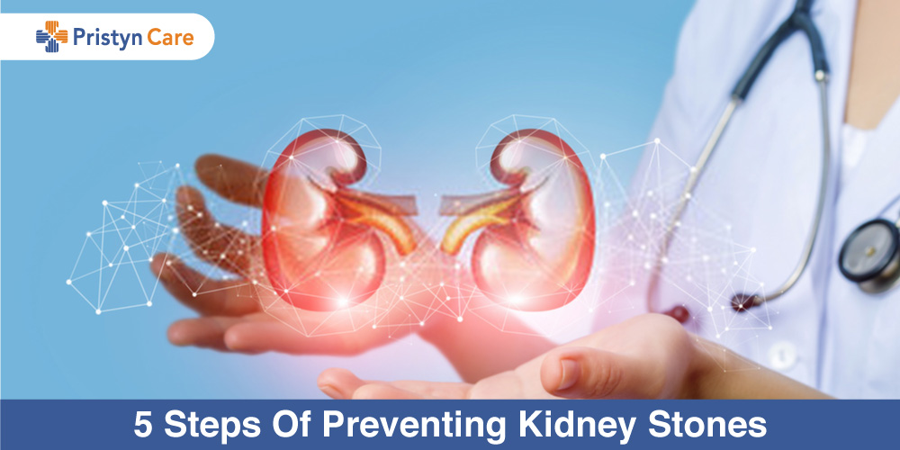 5 Steps Of Preventing Kidney Stones Pristyn Care