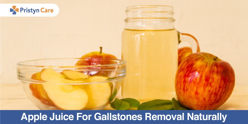Apfelsaft zur Entfernung von Gallensteinen auf natürliche Weise