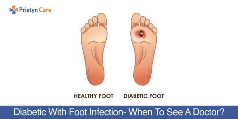 How Does Diabetic Foot Ulcer Start? - Pristyn Care