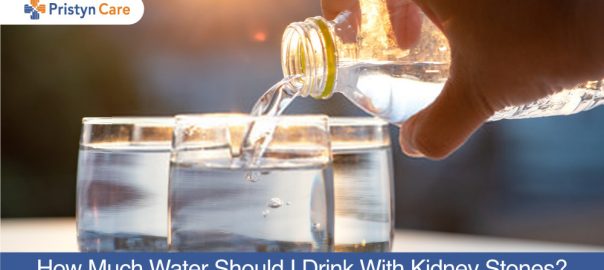 How Much Water Should I Drink With Kidney Stones?