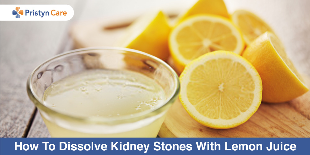 how to dissolve kidney stones with lemon juice