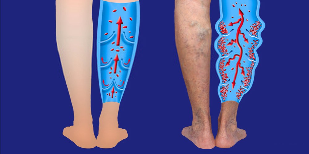 lower-leg-pain-and-swelling-causes-and-treatment-pristyn-care