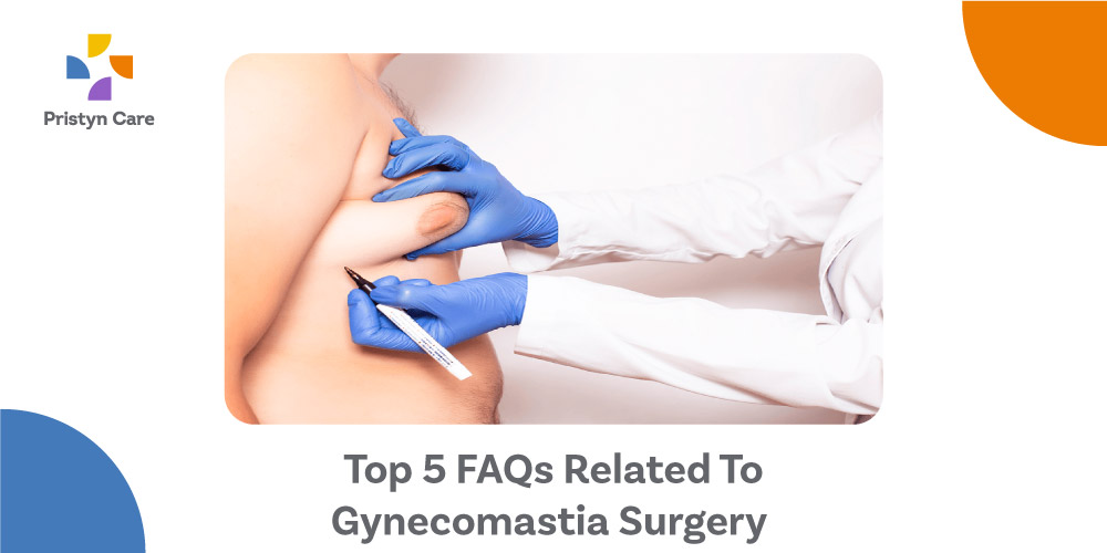 Top-5-FAQs-Related-To-Gynecomastia-Surgery