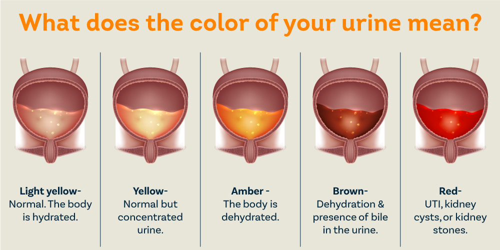 What Causes Blood In Urine Pristyn Care