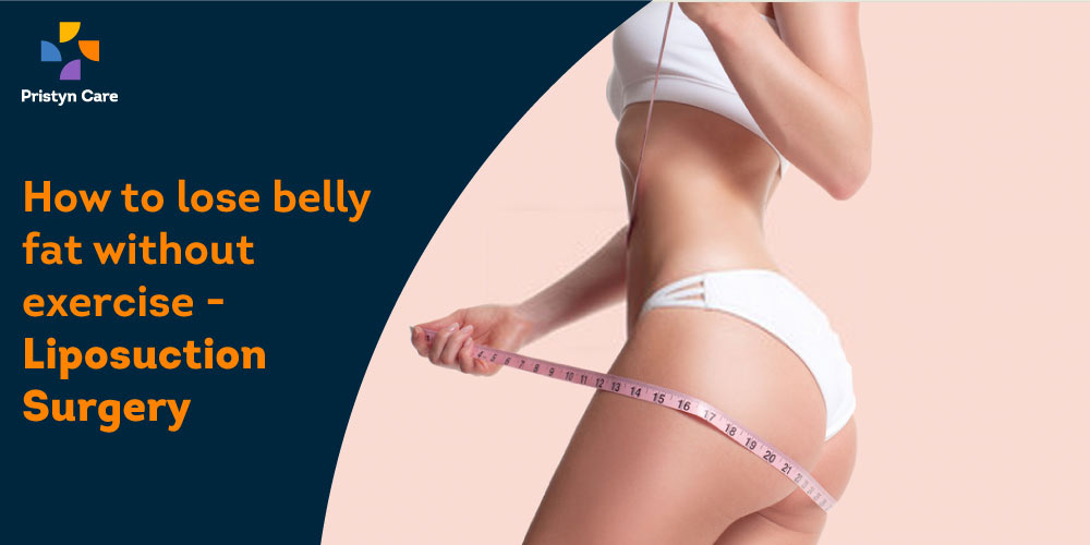 How to lose belly fat without exercise - Liposuction Surgery