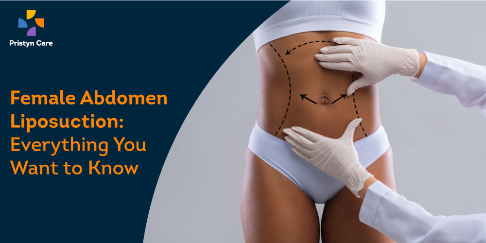 female-abdomen-liposuction