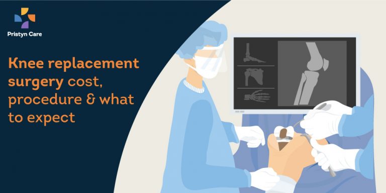 Knee replacement surgery cost, procedure and what to expect - Pristyn Care