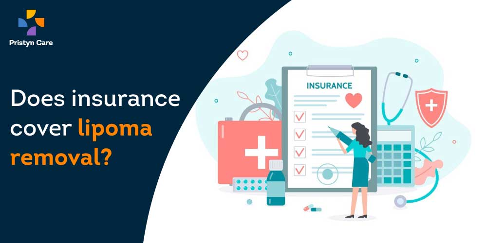 does-insurance-cover-lipoma-removal