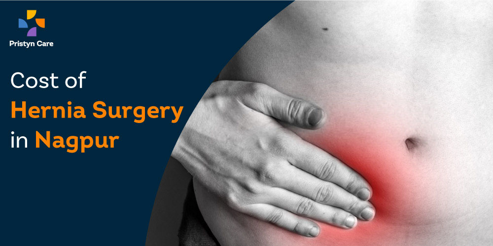 Overall Cost of Hernia Surgery in Nagpur