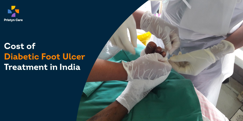 Cost of Diabetic Foot Ulcer Treatment in India