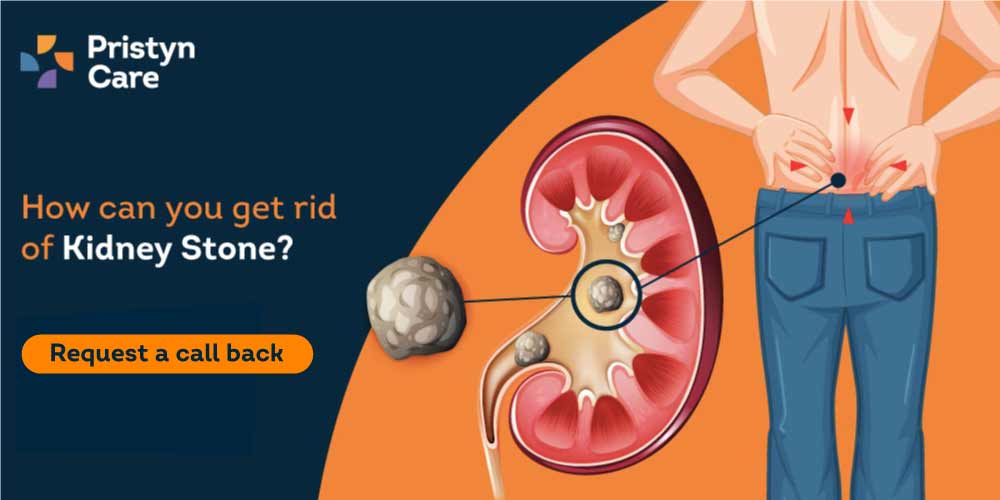 get rid of kidney stones