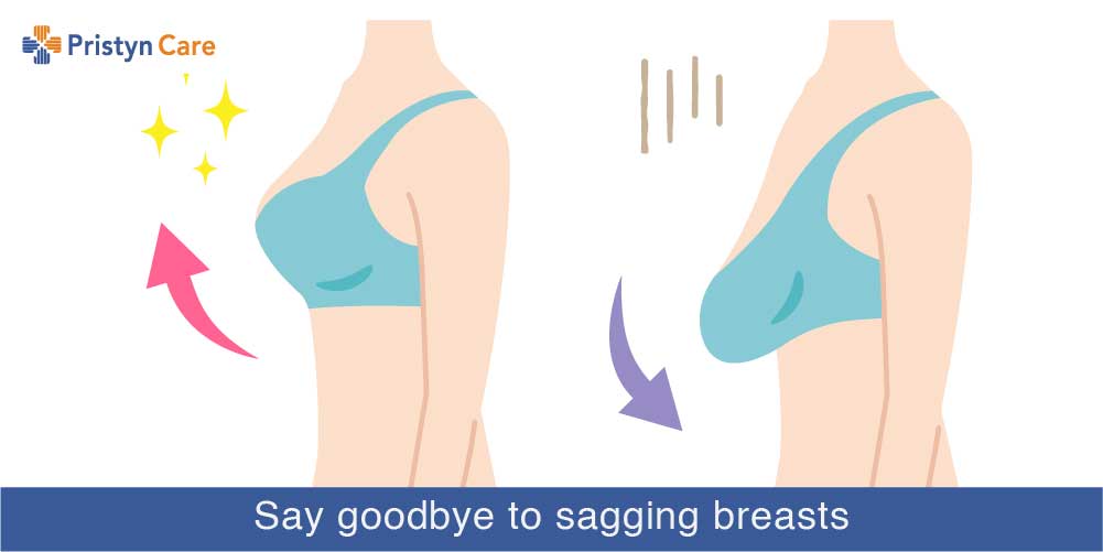 What Is The Best Surgery For Sagging Breasts And It S Cost In Delhi Ncr