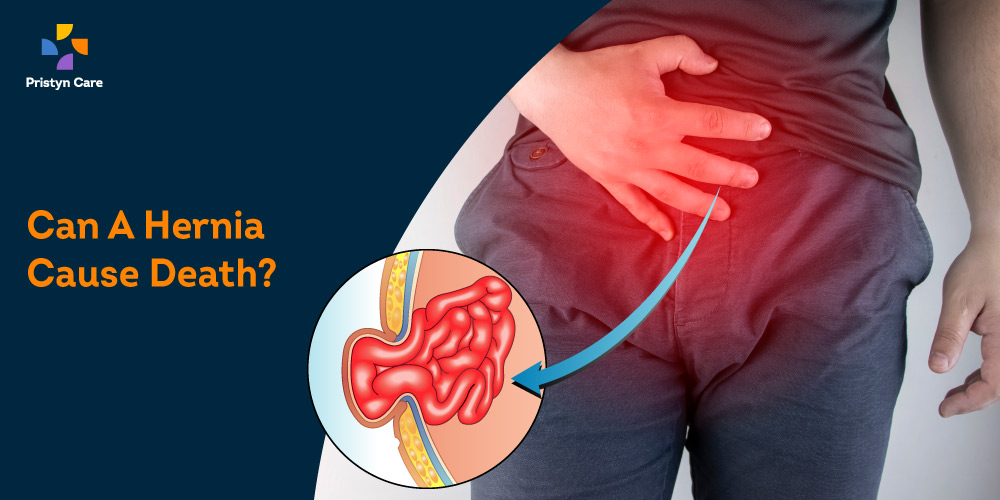Know The Long-Term Side Effects of Hernia Surgery