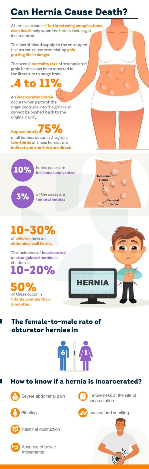 Can A Hernia Cause Death? - Pristyn Care