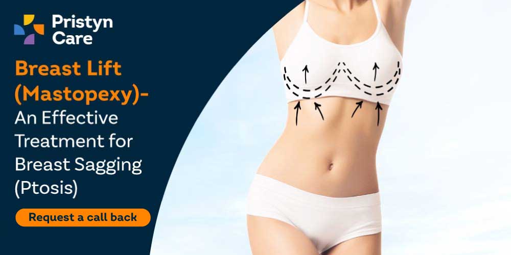 Breast Sagging Causes and Treatment