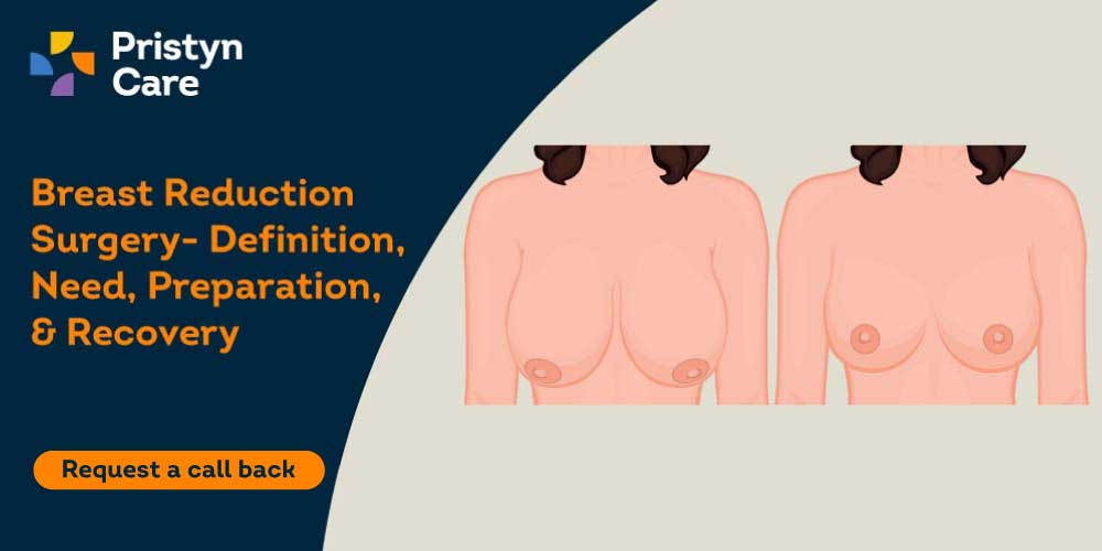 A Guide on What to Wear After a Breast Reduction Surgery
