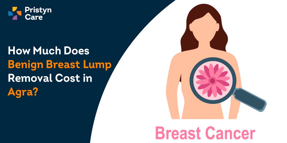 How Much Does Benign Breast Lump Removal Cost in Agra