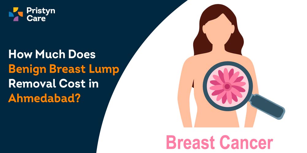 How Much Does Benign Breast Lump Removal Cost in ahmedabad