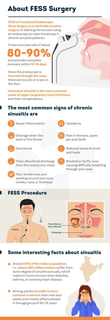 Guide to FESS for sinusitis treatment - Pristyn Care