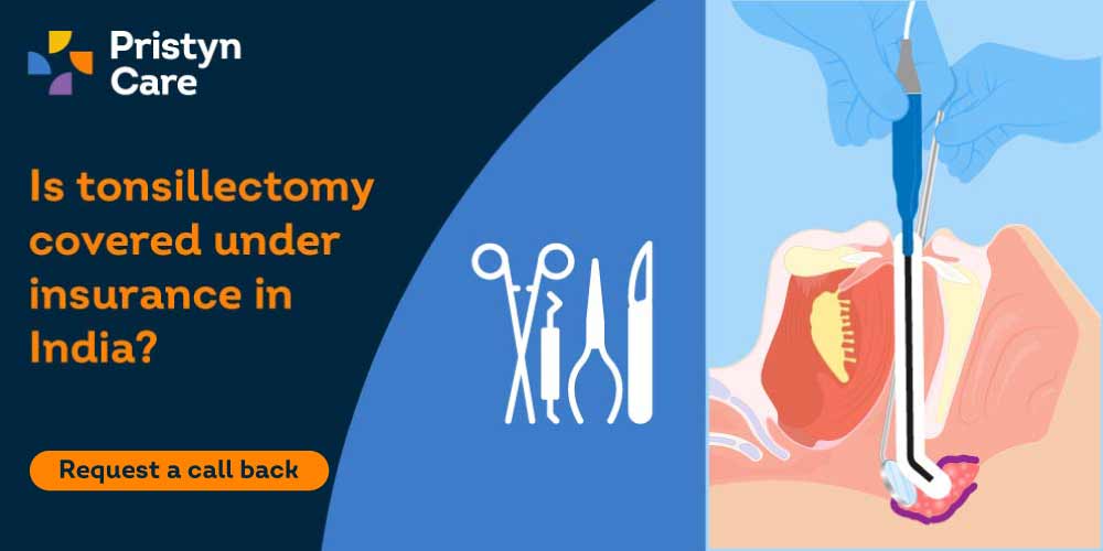 Is-tonsillectomy-covered-under-insurance-in-India