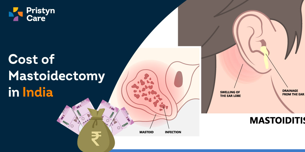 Cost-of-mastoidectomy-in-India