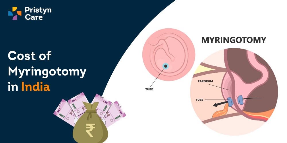 Cost-of-myringotomy-in-India