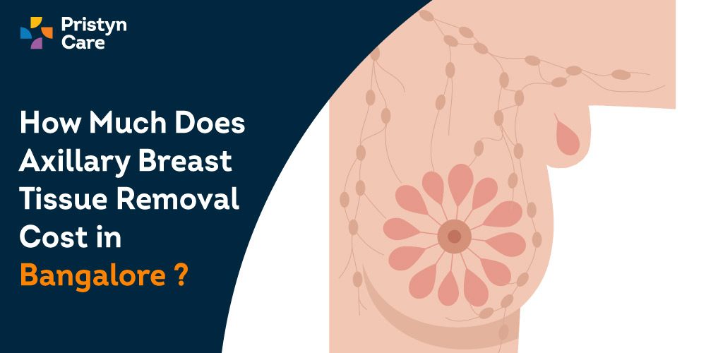 How-Much-Does-Axillary-Breast-Tissue-Removal-Cost-in-Bangalore[1]