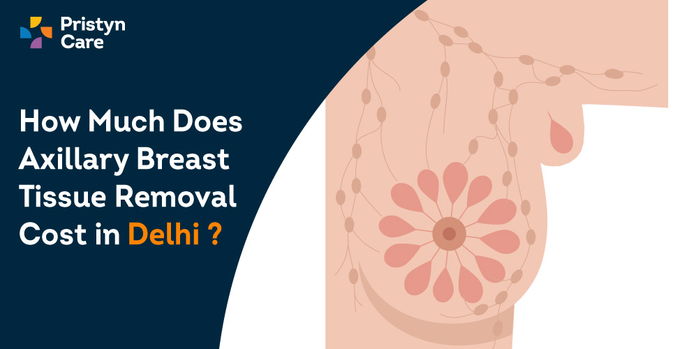 How-Much-Does-Axillary-Breast-Tissue-Removal-Cost-in-Delhi