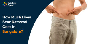 Tattoo Removal in Varanasi India  Laser Tattoo Removal