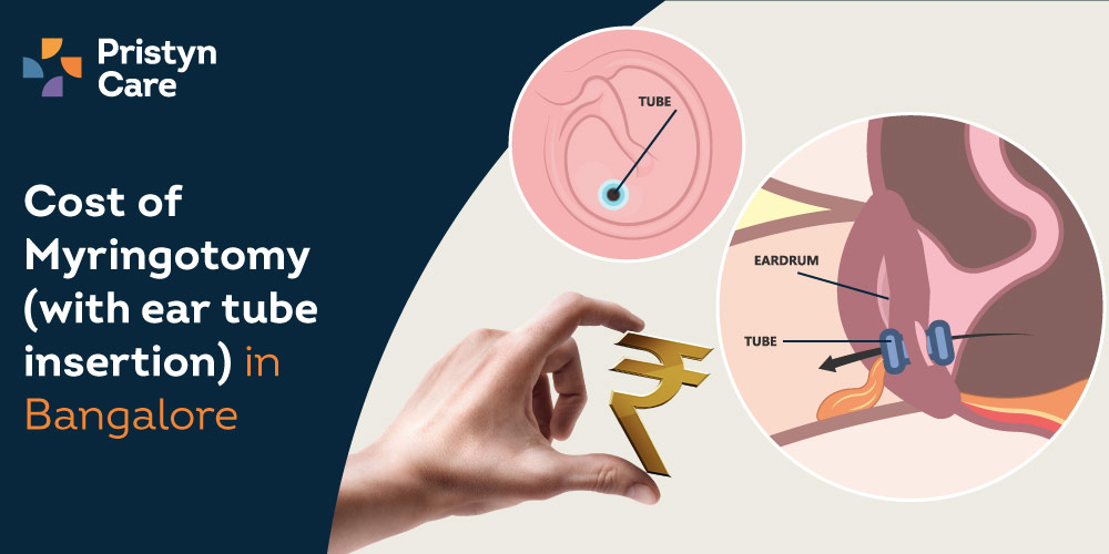 myringotomy cost in Bangalore