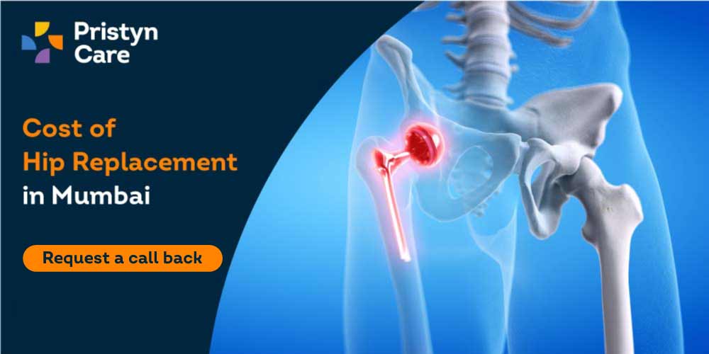 Cost of hip replacement in Mumbai