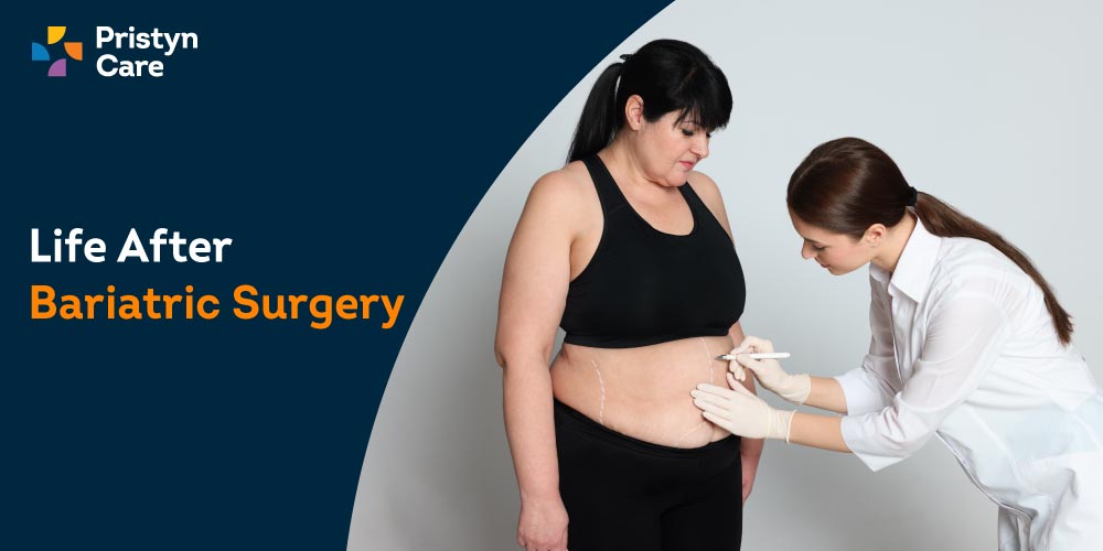 Post-Bariatric: What Can I Expect From My Body After Weight Loss Surgery? -  VIDA Wellness and Beauty