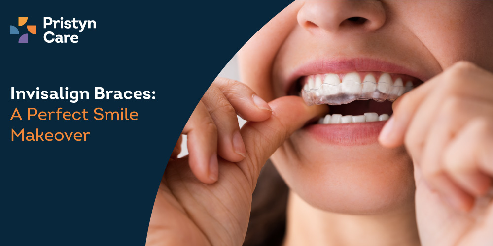 Achieving a Confident Smile with Invisalign Clear Braces