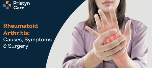 Rheumatoid Arthritis – Causes, Symptoms & Surgery