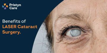 Benefits-of-laser-cataract-surgery