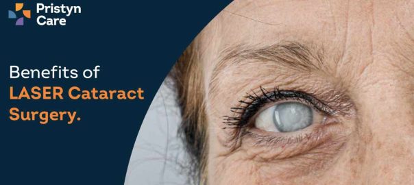 Benefits of Laser Cataract Surgery