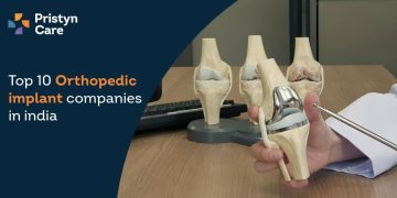 Top Orthopaedic Implant Companies