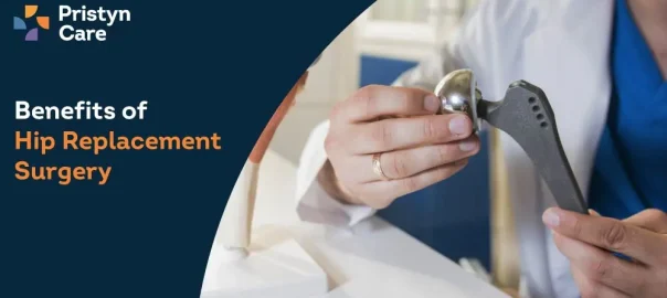 Benefits of Hip Replacement Surgery