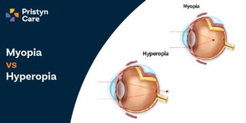 Myopia Vs Hyperopia