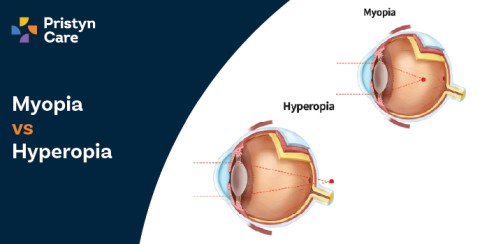 Myopia Vs Hyperopia