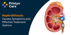 Nephrolithiasis Causes, Symptoms, and Effective Treatment Options