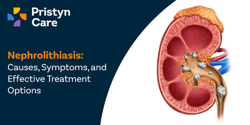 Nephrolithiasis Causes, Symptoms, and Effective Treatment Options