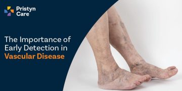 The Importance Of Early Detection In Vascular Disease