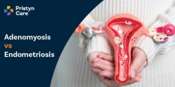 Adenomyosis Vs Endometriosis